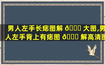 男人左手长痣图解 🐕 大图,男人左手背上有痣图 🐘 解高清图